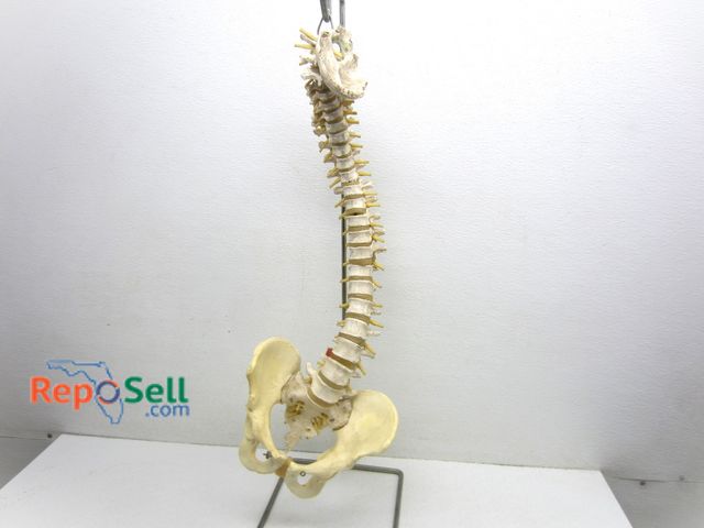 Lot 31-3533 - Spinal Display
