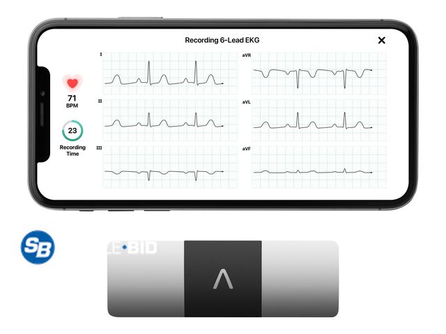 Lot 58-27108 - New AliveCor Kardia Mobile 6L FDA Cleared- Mobile ECG Device