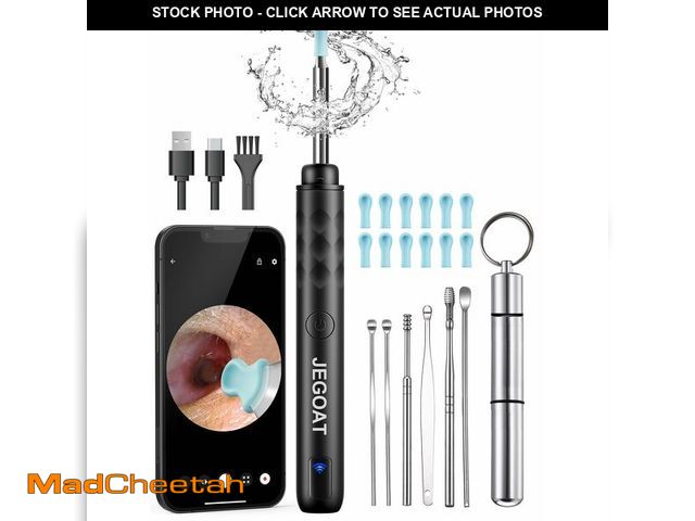 Lot 74-12602298 - Ear Wax Removal Tool Camera, Ear Cleaner with Camera, Ear Scope, Earwax Removal Kit with Otoscope, E...