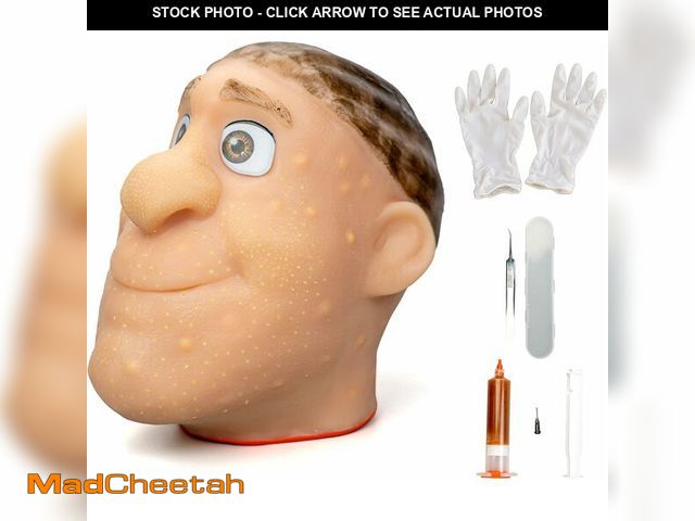 Lot 74-14250638 - brenzo 2026 New Refillable Pimple Popping Toy - Big Head Squeeze Toy with Golden Hair for Stress &am...