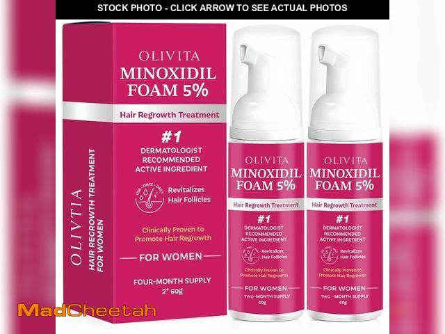 Lot 74-13946896 - 5% Minoxidil Foam for Women Hair Growth: Extra Strength Hair Regrowth Treatment Ã¢â¬â Revitalize ...
