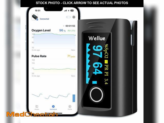 Lot 74-13631788 - Wellue Bluetooth Pulse Oximeter Fingertip, Blood Oxygen Saturation Monitor with Free APP, Batteries,...