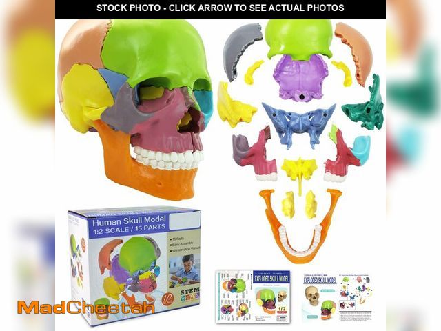 Lot 74-12968268 - 2025 New 15 Parts Anatomy Skull Model,Human Anatomy Exploded Detachable Palm-Sized Mini Human Color ...