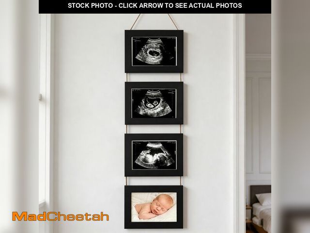 Lot 74-14215777 - Zonvium 4-in-1 Ultrasound Picture Frames, Baby's First Sonogram Photo Album, Pregnancy Announcement ...
