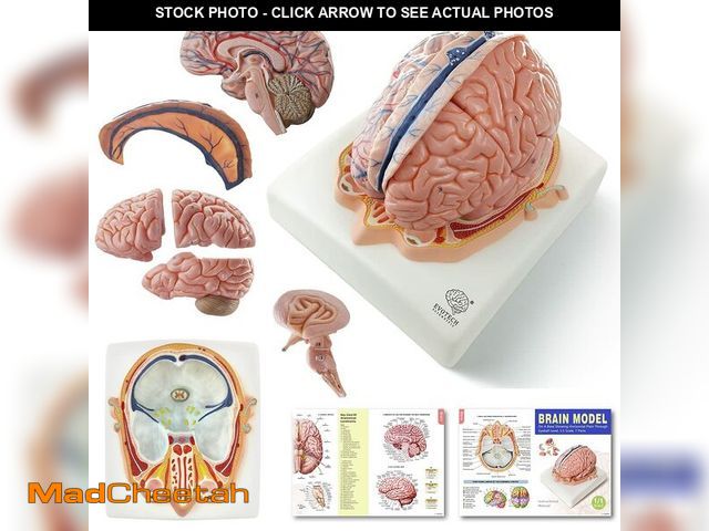 Lot 74-14266864 - EVOTECH SCIENTIFIC Human Brain Model w/Arteries, 7 Parts Life Size Anatomy Brain Model on a Base Sho...