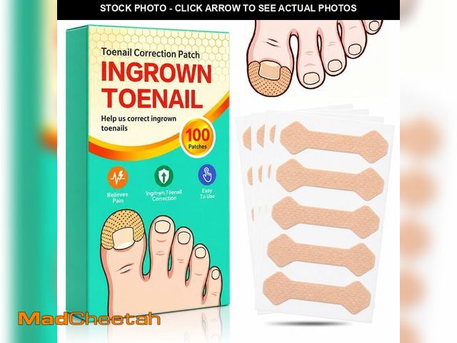 Lot 74-14209867 - Ingrown Toenail Treatment, 100 Pcs Breathable Curved Toenail Corrector, Painless Ingrown Toenail Cor...