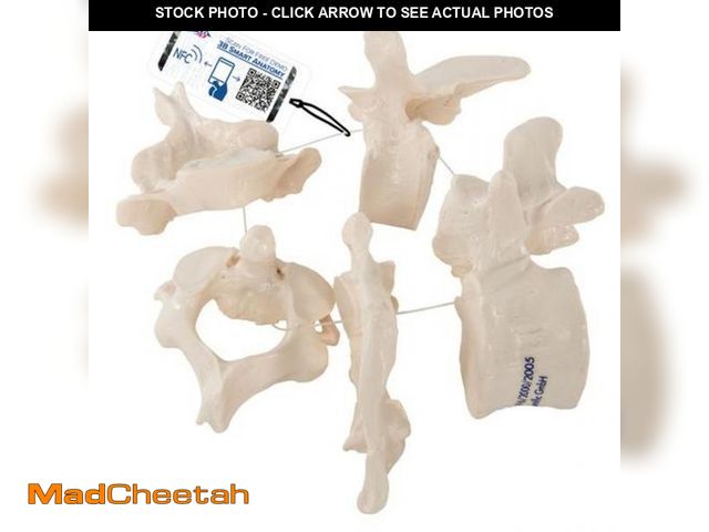Lot 74-12373712 - 5 Vertebrae Anatomy Model - UNUSED